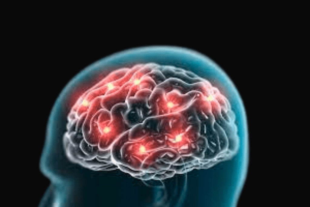 The Human Frontal Lobe